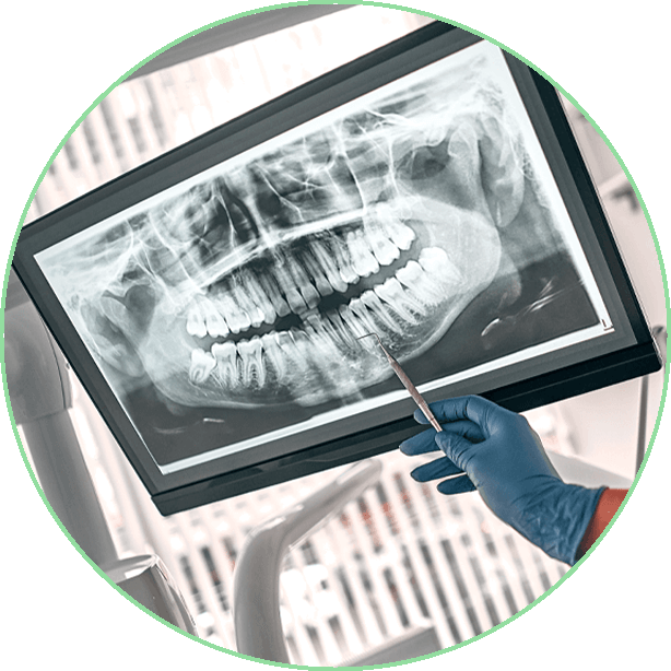 dental xray