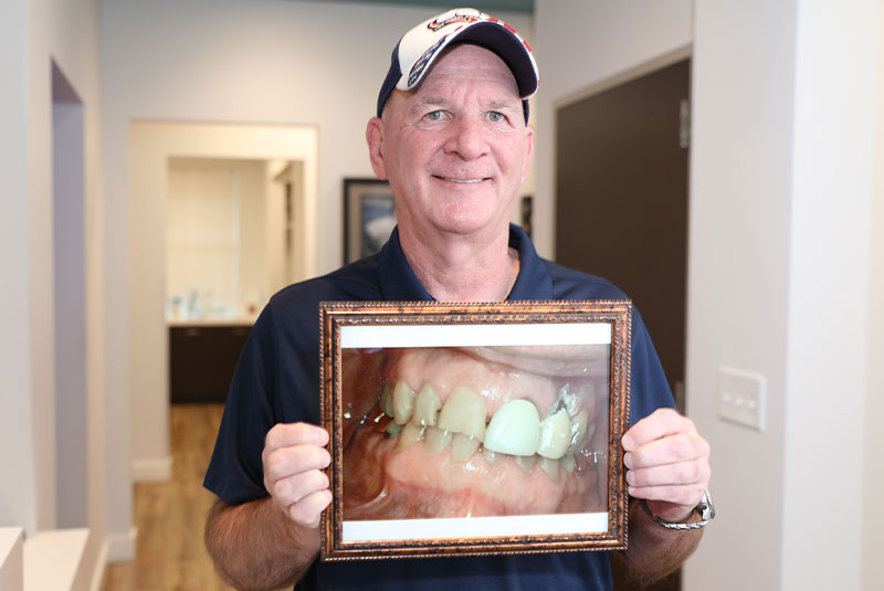 Patient holding up before image after their dental procedure
